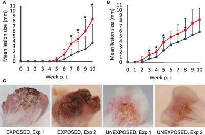Repeated Sand Fly Bites of Infected BALB/c Mice Enhance the Development of Leishmania Lesions